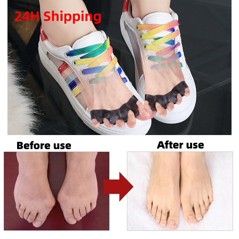 40Pairs Silicone Toe Spacers f - Yoga Toe Separator recensione e prezzo