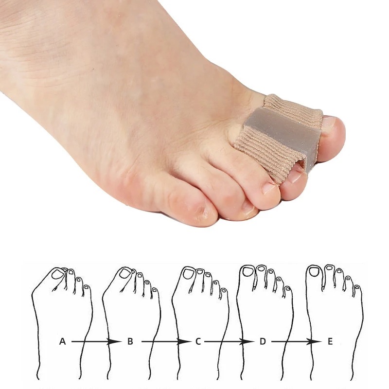 4PC Silicone Toe Separator Fin - Yoga Toe Separator recensione e prezzo